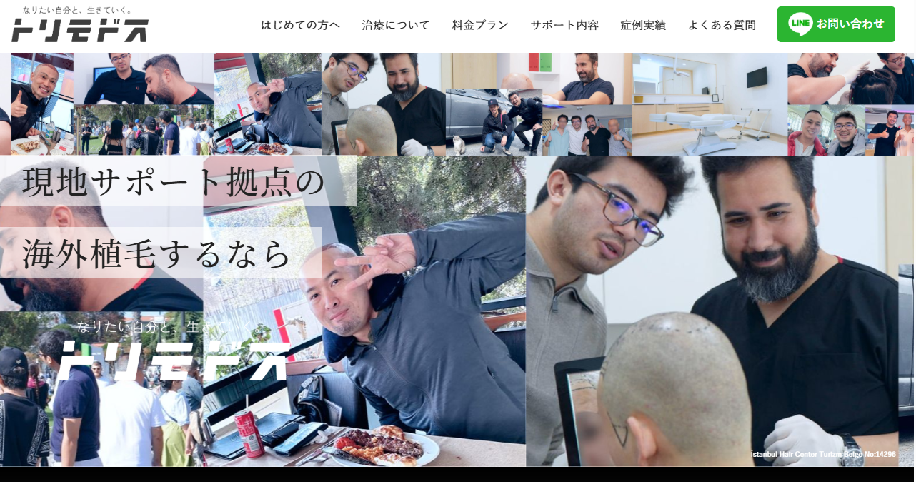 トルコ植毛【トリモドスセンター】